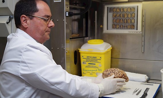 Alberto Rábano habla en Alcobendas de la importancia de donar cerebros para investigación en Alzheimer