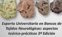 Experto Universitario en Bancos de Tejidos Neurológicos: aspectos teórico-prácticos 3ª Edición