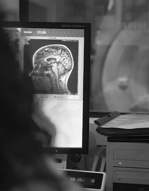 neuroimagen